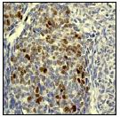 Immunohistochemistry (Formalin/PFA-fixed paraffin-embedded sections) - Anti-Rb (phospho T373) antibody [EP821Y] (AB52975)