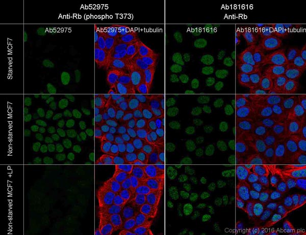 Immunocytochemistry/ Immunofluorescence - Anti-Rb (phospho T373) antibody [EP821Y] - BSA and Azide free (AB219158)