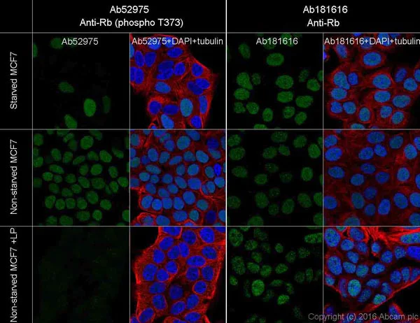 Immunocytochemistry/ Immunofluorescence - Anti-Rb (phospho T373) antibody [EP821Y] - BSA and Azide free (AB219158)