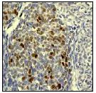 Immunohistochemistry (Formalin/PFA-fixed paraffin-embedded sections) - Anti-Rb (phospho T373) antibody [EP821Y] - BSA and Azide free (AB219158)