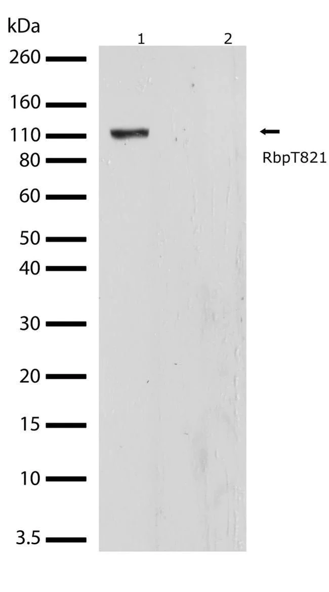 Western blot - Anti-Rb (phospho T821) Antibody [RP23040072] (AB313409)
