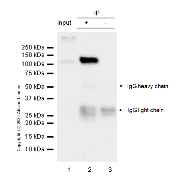 Immunoprecipitation - Anti-Rb (phospho T821 + T826) antibody [EPR28648-126] (AB323846)