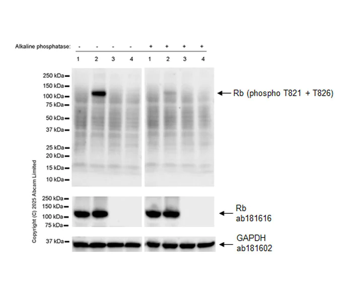 Western blot - Anti-Rb (phospho T821 + T826) antibody [EPR28648-126] (AB323846)