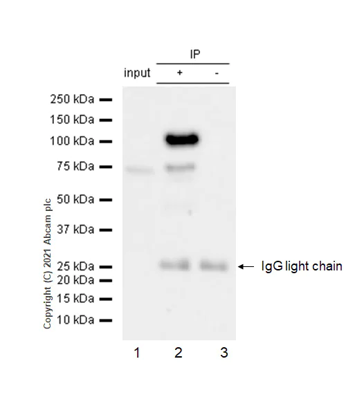 Immunoprecipitation - Anti-Rb (phospho T826) antibody [EPR5351] - BSA and Azide free (AB219159)