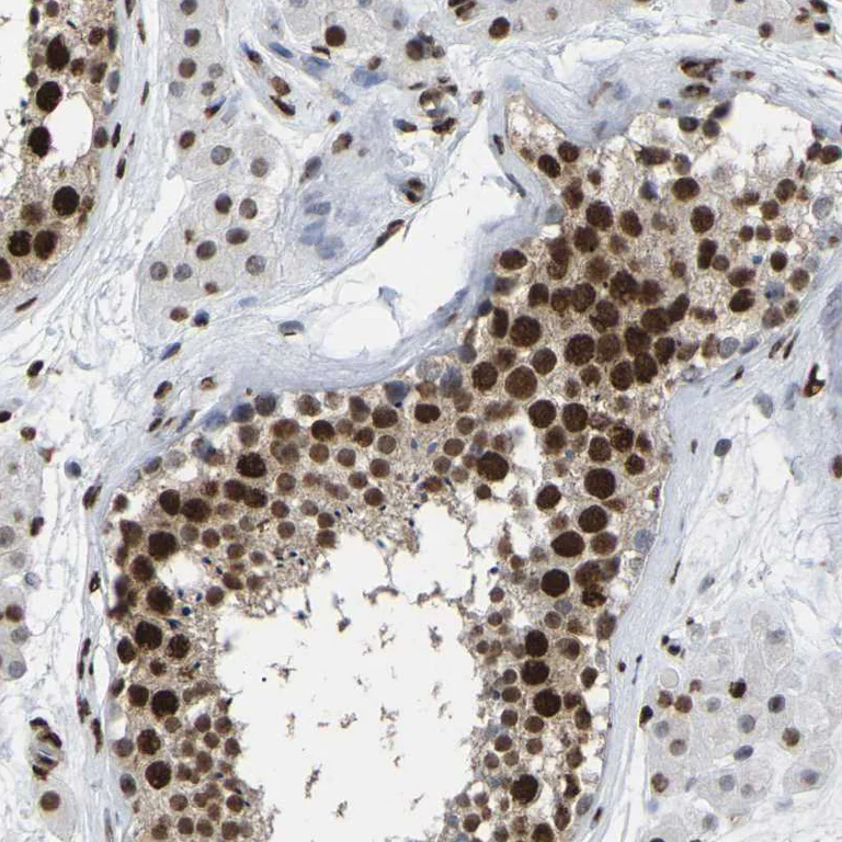 Immunohistochemistry (Formalin/PFA-fixed paraffin-embedded sections) - Anti-Rb2 p130 antibody (AB244373)