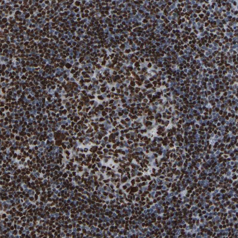 Immunohistochemistry (Formalin/PFA-fixed paraffin-embedded sections) - Anti-Rb2 p130 antibody (AB244373)