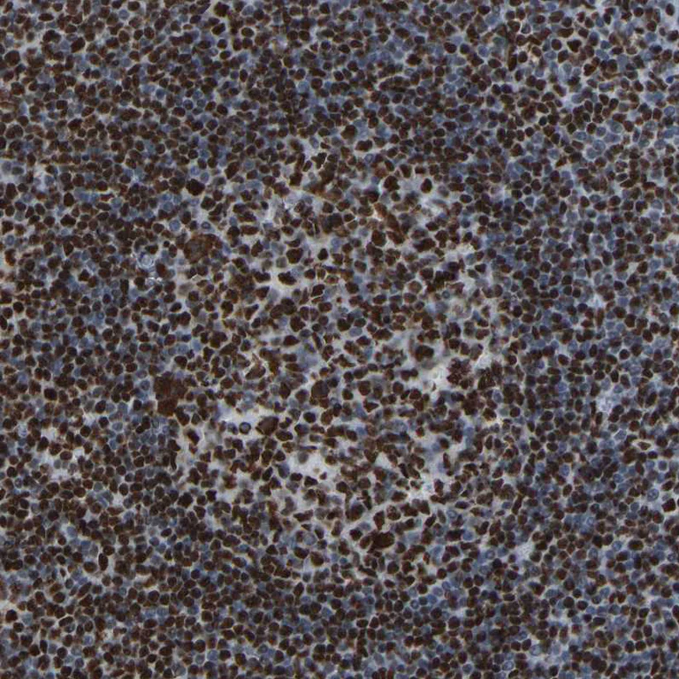 Immunohistochemistry (Formalin/PFA-fixed paraffin-embedded sections) - Anti-Rb2 p130 antibody (AB244373)