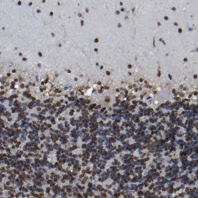 Immunohistochemistry (Formalin/PFA-fixed paraffin-embedded sections) - Anti-Rb2 p130 antibody (AB244373)