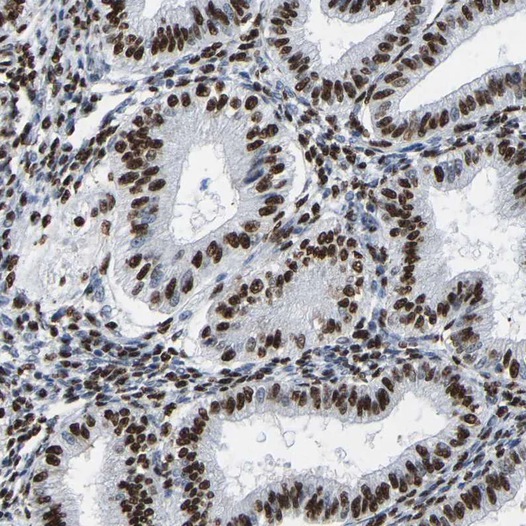 Immunohistochemistry (Formalin/PFA-fixed paraffin-embedded sections) - Anti-Rb2 p130 antibody (AB244373)