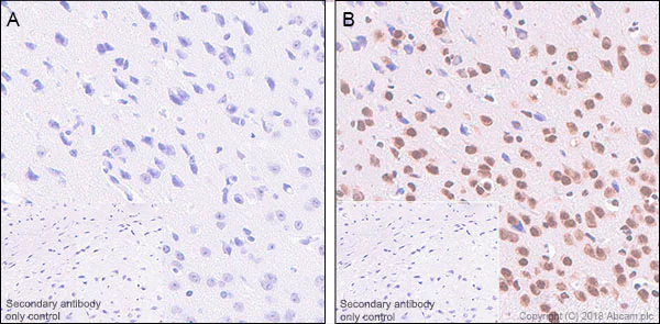 Immunohistochemistry (Formalin/PFA-fixed paraffin-embedded sections) - Anti-Rb2 p130 (phospho S952) antibody [EP2387AY] (AB68136)