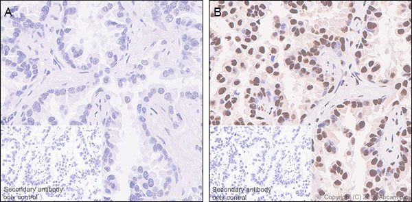Immunohistochemistry (Formalin/PFA-fixed paraffin-embedded sections) - Anti-Rb2 p130 (phospho S952) antibody [EP2387AY] (AB68136)