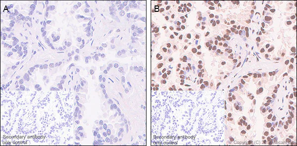 Immunohistochemistry (Formalin/PFA-fixed paraffin-embedded sections) - Anti-Rb2 p130 (phospho S952) antibody [EP2387AY] (AB68136)