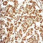 Immunohistochemistry (Formalin/PFA-fixed paraffin-embedded sections) - Anti-Rb2 p130 (phospho S952) antibody [EP2387AY] (AB68136)