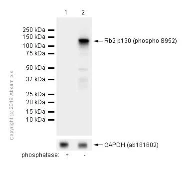 Western blot - Anti-Rb2 p130 (phospho S952) antibody [EP2387AY] (AB68136)