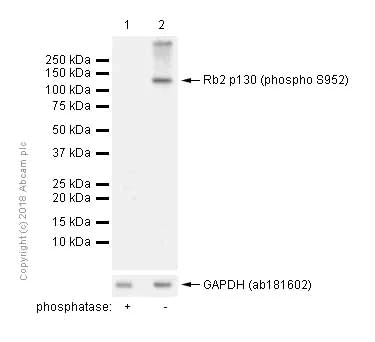 Western blot - Anti-Rb2 p130 (phospho S952) antibody [EP2387AY] (AB68136)