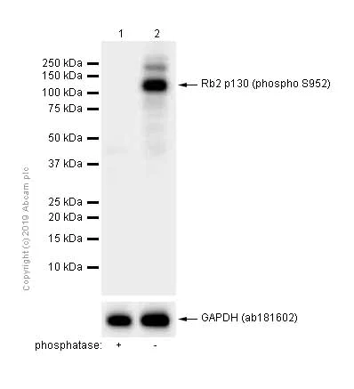 Western blot - Anti-Rb2 p130 (phospho S952) antibody [EP2387AY] (AB68136)