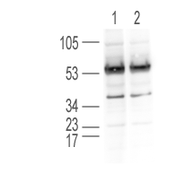 Western blot - Anti-RBBP4 antibody (AB1765), expandable thumbnail