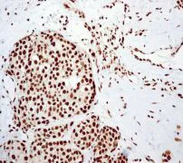Immunohistochemistry (Formalin/PFA-fixed paraffin-embedded sections) - Anti-RBBP4 antibody [EPR3411] - ChIP Grade (AB79416)