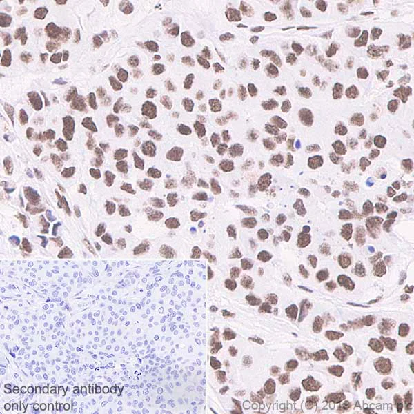 Immunohistochemistry (Formalin/PFA-fixed paraffin-embedded sections) - Anti-RBBP4 antibody [EPR3411] - ChIP Grade (AB79416)