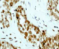 Immunohistochemistry (Formalin/PFA-fixed paraffin-embedded sections) - Anti-RBBP4 antibody [EPR3412] - ChIP Grade (AB92344)
