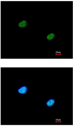 Immunocytochemistry/ Immunofluorescence - Anti-RbBP5 antibody (AB154755), expandable thumbnail
