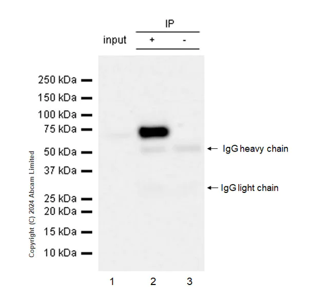 Immunoprecipitation - Anti-RbBP5 antibody [EPR27128-112] (AB322656)