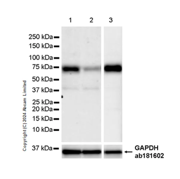 Western blot - Anti-RbBP5 antibody [EPR27128-112] (AB322656)