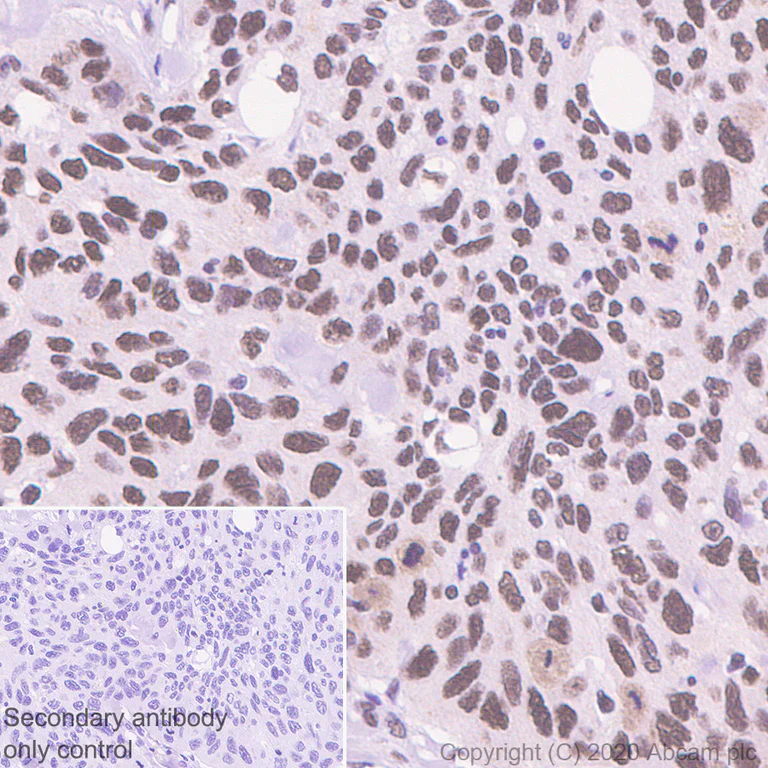 Immunohistochemistry (Formalin/PFA-fixed paraffin-embedded sections) - Anti-RBBP7 antibody [EPR23796-74] - ChIP Grade - BSA and Azide free (AB273882)