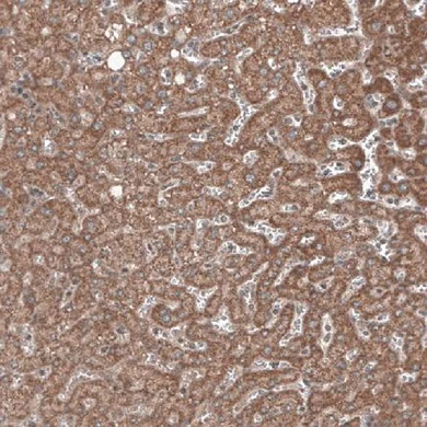 Immunohistochemistry (Formalin/PFA-fixed paraffin-embedded sections) - Anti-RBCK1 antibody [CL4289] (AB219955)