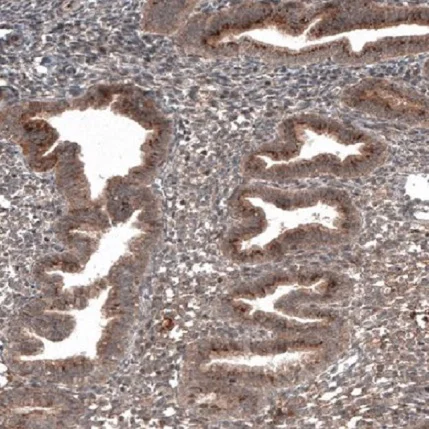 Immunohistochemistry (Formalin/PFA-fixed paraffin-embedded sections) - Anti-RBCK1 antibody [CL4289] (AB219955)