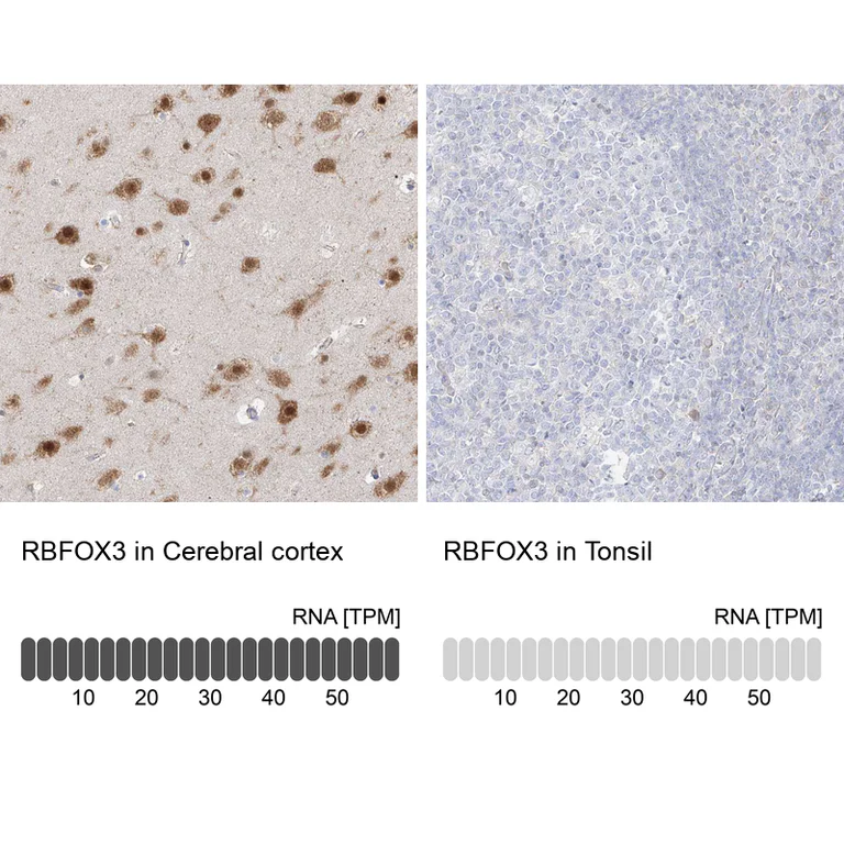 Immunohistochemistry (Formalin/PFA-fixed paraffin-embedded sections) - Anti-RBFOX3 Antibody (AB327220)