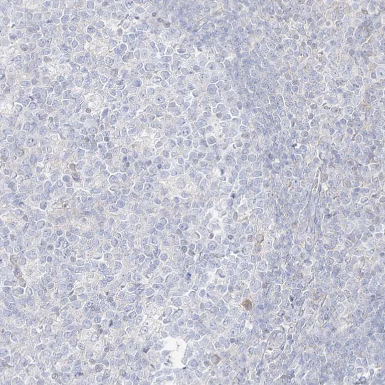 Immunohistochemistry (Formalin/PFA-fixed paraffin-embedded sections) - Anti-RBFOX3 Antibody (AB327220)