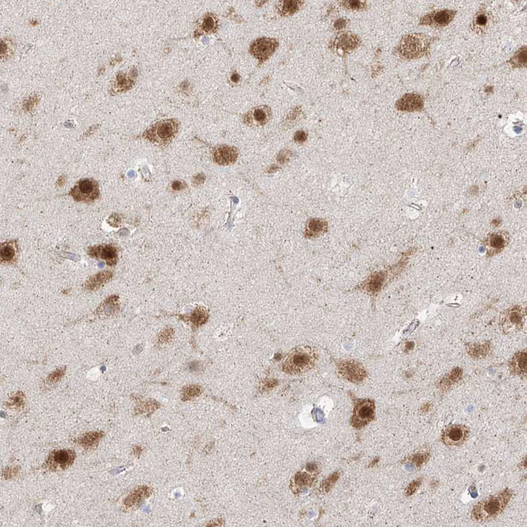Immunohistochemistry (Formalin/PFA-fixed paraffin-embedded sections) - Anti-RBFOX3 Antibody (AB327220)