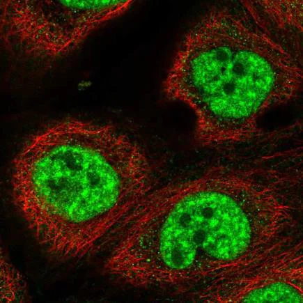 Immunocytochemistry/ Immunofluorescence - Anti-RBM10/S1-1 antibody (AB220847)
