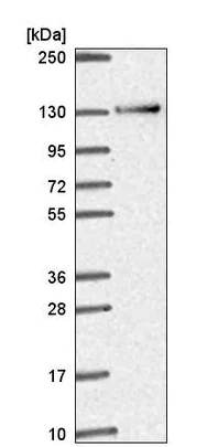 Western blot - Anti-RBM10/S1-1 antibody (AB220847)