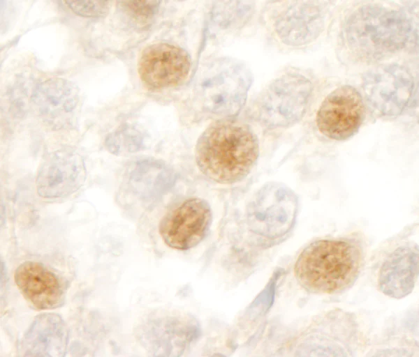 Immunohistochemistry (Formalin/PFA-fixed paraffin-embedded sections) - Anti-RBM10/S1-1 antibody (AB72423)
