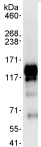 Immunoprecipitation - Anti-RBM10/S1-1 antibody (AB72423)