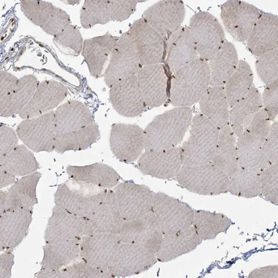 Immunohistochemistry (Formalin/PFA-fixed paraffin-embedded sections) - Anti-RBM10/S1-1 antibody - N-terminal (AB224149)