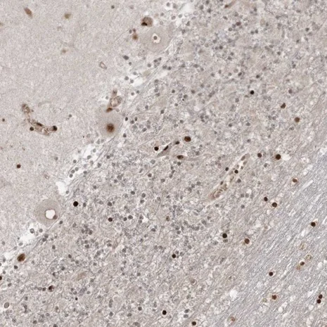 Immunohistochemistry (Formalin/PFA-fixed paraffin-embedded sections) - Anti-RBM10/S1-1 antibody - N-terminal (AB224149)
