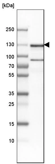 Western blot - Anti-RBM10/S1-1 antibody - N-terminal (AB224149)