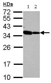 Western blot - Anti-RBM11 antibody (AB127553)