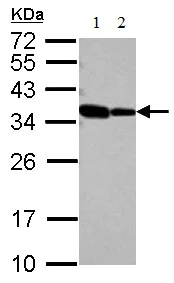 Western blot - Anti-RBM11 antibody (AB127553)