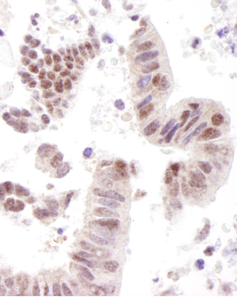 Immunohistochemistry (Formalin/PFA-fixed paraffin-embedded sections) - Anti-RBM14 antibody (AB12325)