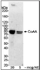 Western blot - Anti-RBM14 antibody (AB12325)