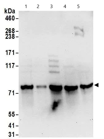 Western blot - Anti-RBM14 antibody (AB70636)