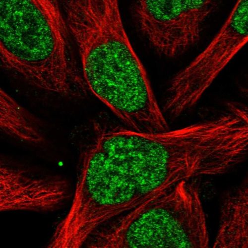 Immunocytochemistry/ Immunofluorescence - Anti-Rbm15/OTT antibody (AB244374), expandable thumbnail