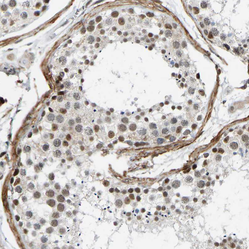 Immunohistochemistry (Formalin/PFA-fixed paraffin-embedded sections) - Anti-Rbm15/OTT antibody (AB244374), expandable thumbnail