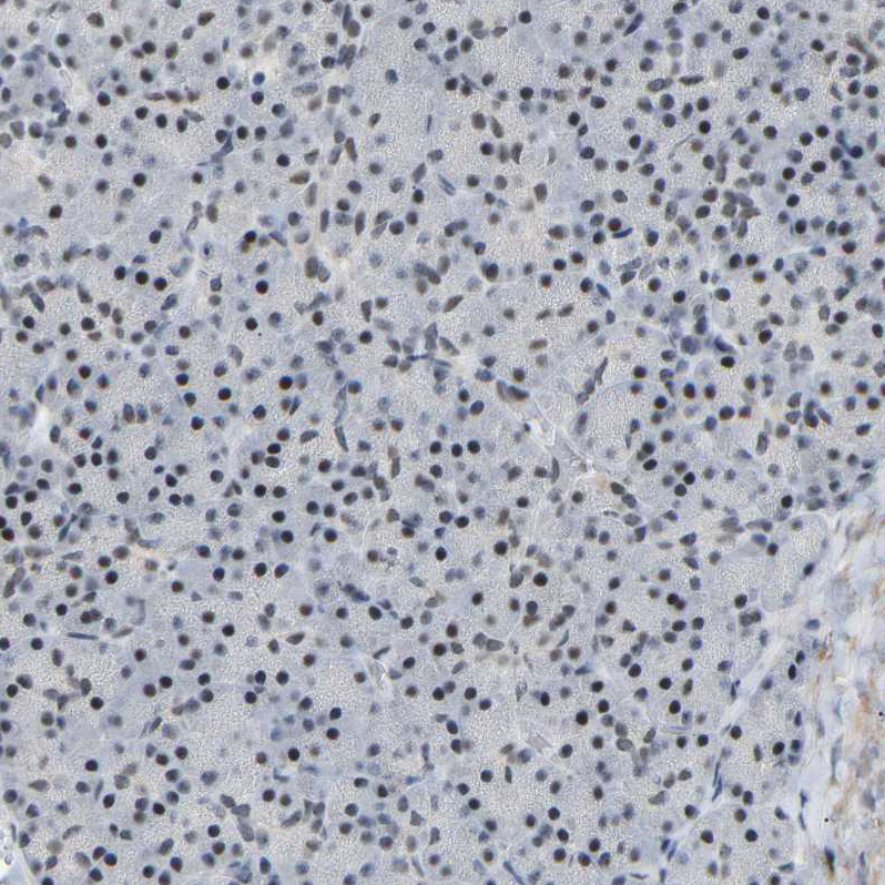 Immunohistochemistry (Formalin/PFA-fixed paraffin-embedded sections) - Anti-Rbm15/OTT antibody (AB244374), expandable thumbnail