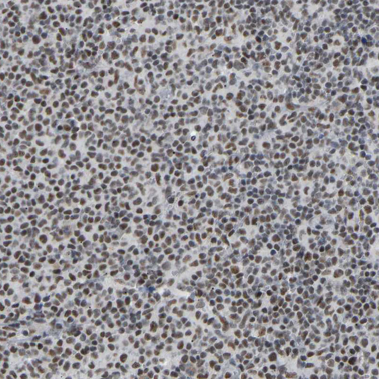 Immunohistochemistry (Formalin/PFA-fixed paraffin-embedded sections) - Anti-Rbm15/OTT antibody (AB244374)