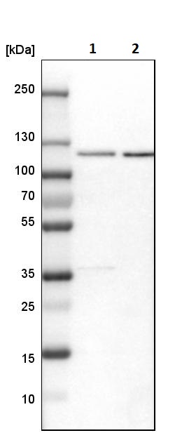Western blot - Anti-Rbm15/OTT antibody (ab244374), expandable thumbnail